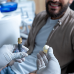 Dinți lipsă? Descoperă soluția de lungă durată recomandată de Smiles by Dr. Buza