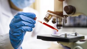 Rezultate fără precedent în oncologie: O injecție experimentală „topește” tumorile pacienților care nu mai răspundeau la chimioterapie